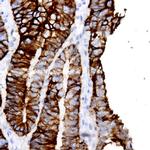 Occludin Antibody in Immunohistochemistry (Paraffin) (IHC (P))