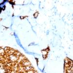 P40 Antibody in Immunohistochemistry (Paraffin) (IHC (P))