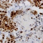 PCNA Antibody in Immunohistochemistry (Paraffin) (IHC (P))