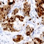 PCPTP1 Antibody in Immunohistochemistry (Paraffin) (IHC (P))