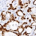 PI3K p85 beta Antibody in Immunohistochemistry (Paraffin) (IHC (P))