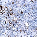 Plasma Cell Marker Antibody in Immunohistochemistry (Paraffin) (IHC (P))