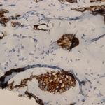 Podocalyxin Antibody in Immunohistochemistry (Paraffin) (IHC (P))