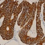PPP2R5C Antibody in Immunohistochemistry (Paraffin) (IHC (P))