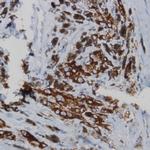 Red Blood Cell Antibody in Immunohistochemistry (Paraffin) (IHC (P))