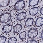 Renal Cell Carcinoma (RCC, gp200) Antibody in Immunohistochemistry (Paraffin) (IHC (P))