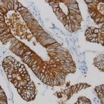 RRUT-3 Antibody in Immunohistochemistry (Paraffin) (IHC (P))