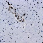 Sgt-1A Antibody in Immunohistochemistry (Paraffin) (IHC (P))