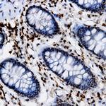 SKP2 Antibody in Immunohistochemistry (Paraffin) (IHC (P))