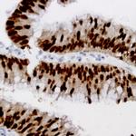 STAT3 Antibody in Immunohistochemistry (Paraffin) (IHC (P))