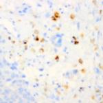 Tenascin C Antibody in Immunohistochemistry (Paraffin) (IHC (P))