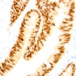 Thymidylate Synthase Antibody in Immunohistochemistry (Paraffin) (IHC (P))