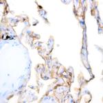 TRIM29 (Lung Squamous Cell Carcinoma Marker) Antibody in Immunohistochemistry (Paraffin) (IHC (P))