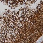 Ubiquitin Antibody in Immunohistochemistry (Paraffin) (IHC (P))