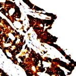 Catenin-gamma Antibody in Immunohistochemistry (Paraffin) (IHC (P))