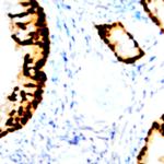 AMACR Antibody in Immunohistochemistry (Paraffin) (IHC (P))