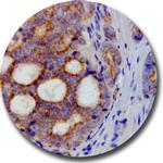 AMACR Antibody in Immunohistochemistry (Paraffin) (IHC (P))