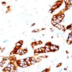 Cytokeratin 10 Antibody in Immunohistochemistry (Paraffin) (IHC (P))