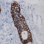 Cytokeratin 19 Antibody in Immunohistochemistry (Paraffin) (IHC (P))