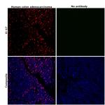 Ki-67 Antibody in Immunohistochemistry (Paraffin) (IHC (P))