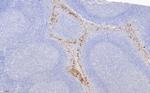 P16-INK4A Antibody in Immunohistochemistry (Paraffin) (IHC (P))