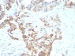 CD269/TNFRSF17/BCMA (B-Cell Maturation Protein) Monoclonal Antibody (BCMA/7253)