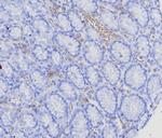 CD269/TNFRSF17/BCMA (B-Cell Maturation Protein) Recombinant Rabbit Monoclonal Antibody (CD269/8125R)