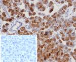ROR-gamma/RORC (RAR-related Orphan Receptor C) Recombinant Rabbit Monoclonal Antibody (RORC/8132R)