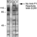 Phosphoserine Antibody in Western Blot (WB)