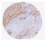 Smooth Muscle Actin Antibody in Immunohistochemistry (Paraffin) (IHC (P))