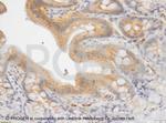 Desmoglein 1/2 Antibody in Immunohistochemistry (IHC)