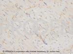 Desmoglein 1/2 Antibody in Immunohistochemistry (IHC)