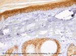 Desmoglein 1/2 Antibody in Immunohistochemistry (IHC)
