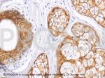 Desmoglein 1/2 Antibody in Immunohistochemistry (IHC)