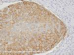 Ep-CAM Antibody in Immunohistochemistry (IHC)