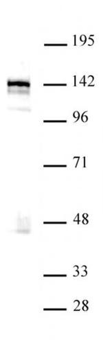 BRD8 / SMAP2 Antibody in Western Blot (WB)