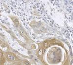 Cytokeratin 13 Antibody in Immunohistochemistry (Paraffin) (IHC (P))
