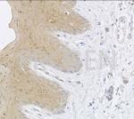 Cytokeratin 13 Antibody in Immunohistochemistry (Paraffin) (IHC (P))