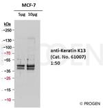 Cytokeratin 13 Antibody in Western Blot (WB)