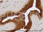 Uroplakin III Antibody in Immunohistochemistry (IHC)