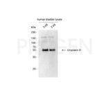 Uroplakin III Antibody in Western Blot (WB)