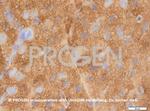 Synaptophysin Antibody in Immunohistochemistry (IHC)