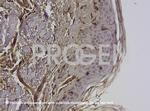 Vimentin Antibody in Immunohistochemistry (IHC)