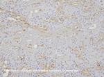 Vimentin Antibody in Immunohistochemistry (IHC)