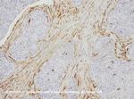 Vimentin Antibody in Immunohistochemistry (IHC)