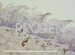 Vimentin Antibody in Immunohistochemistry (IHC)