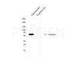 Vimentin Antibody in Western Blot (WB)
