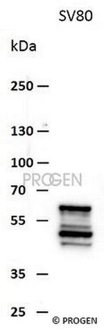 Vimentin Antibody in Western Blot (WB)