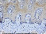 Cytokeratin Pan Type I/II Antibody in Immunohistochemistry (IHC)