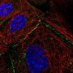 Desmoplakin 1 Antibody in Immunocytochemistry (ICC/IF)